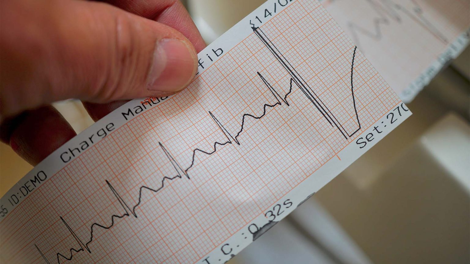 Hand holding an electrocardiogram printout.