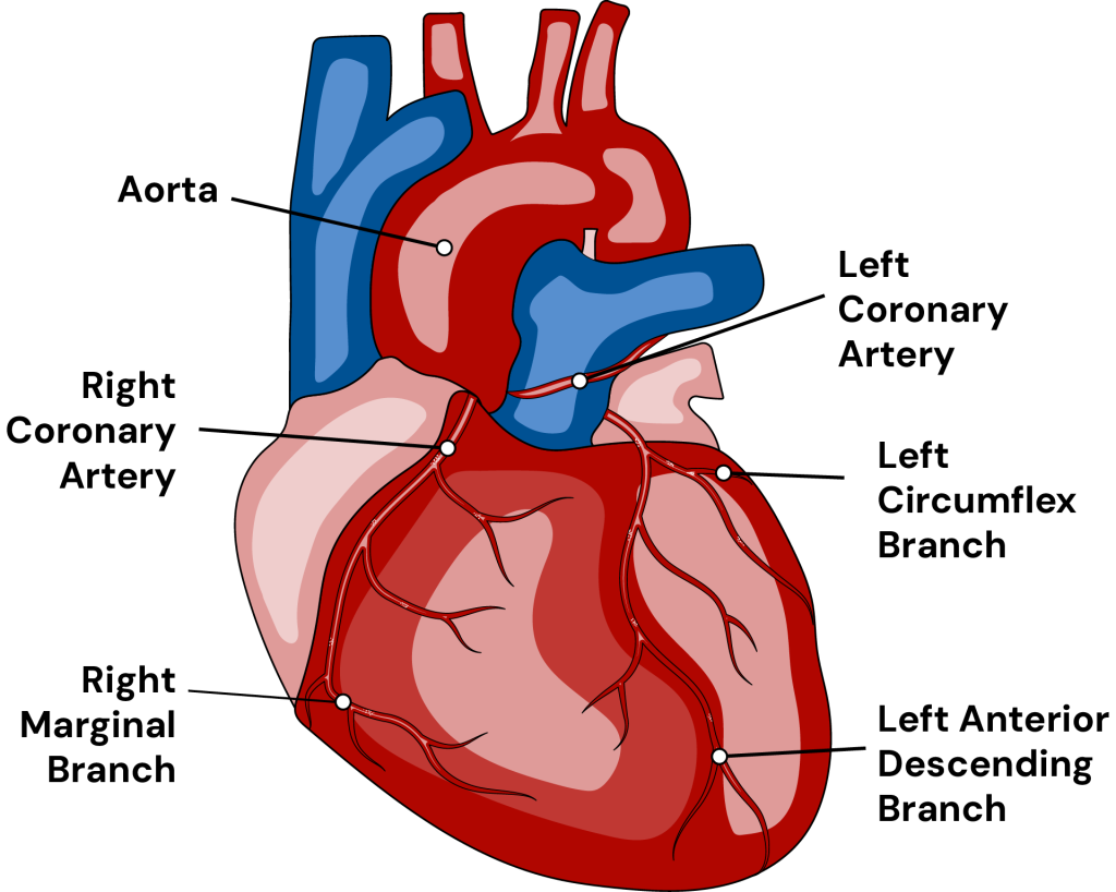 Illustration of the human heart highlighting major arteries: Aorta, Right and Left Coronary Arteries, and their branches.